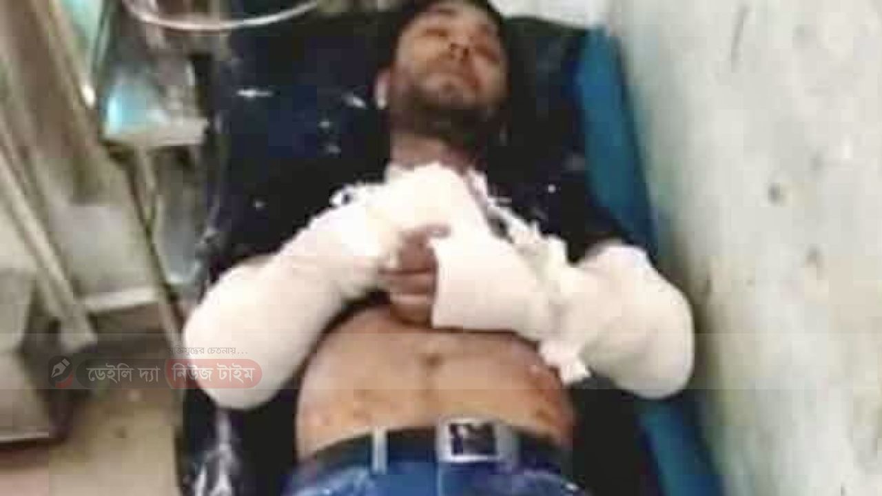 বগুড়া শাহজানপুরে জমিজমা নিয়ে বিরোধ হামলার শিকার একজনের মৃত্যু।