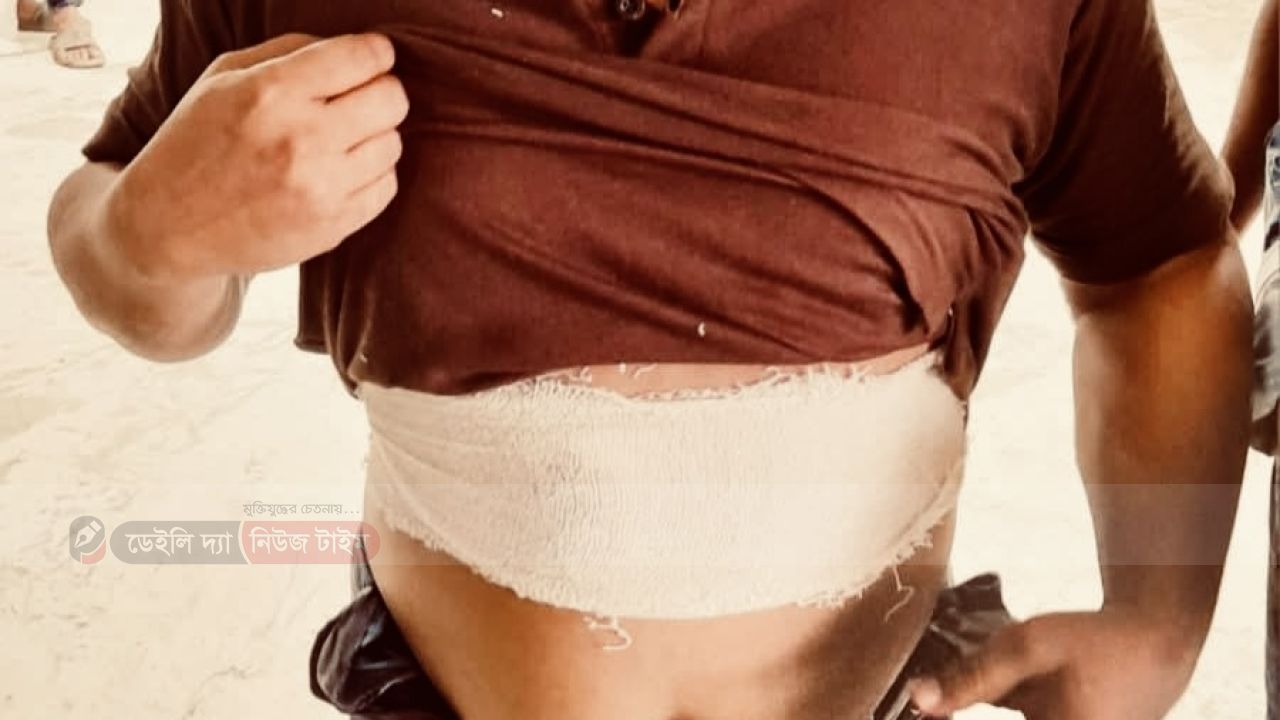 বগুড়া দুপচাঁচিয়ায় বড় ভাইয়ের চাকুর আঘাতে ছোট ভাই আহত