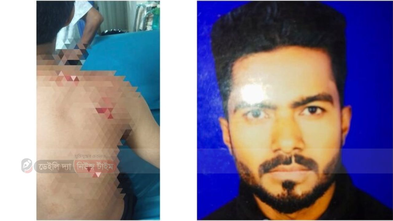 বগুড়ায় আবারও ছুরিকাঘাত, কৈপাড়ায় রতন মিয়া আহত