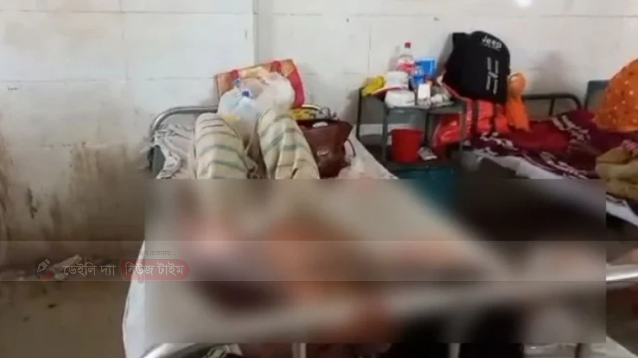 ঝিকরগাছায় স্বামীর গায়ে গরম পানি ঢেলে দিল স্ত্রী, হাসপাতালে ভর্তি