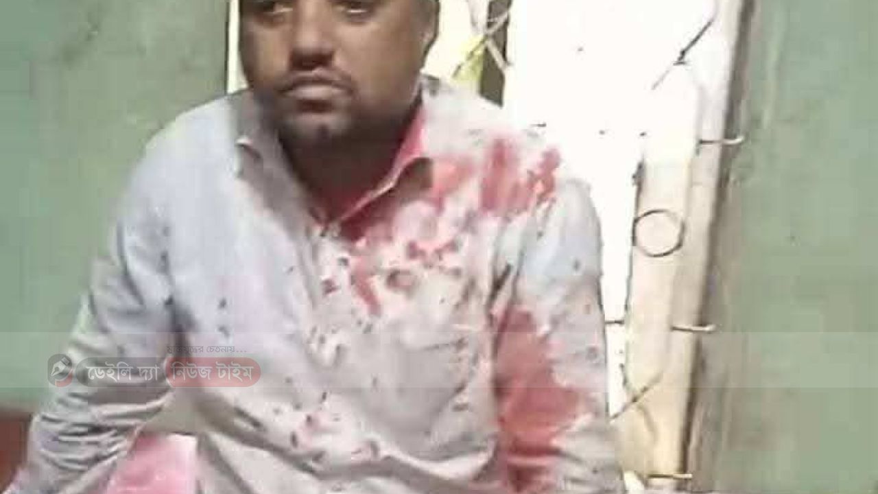 পারিবারিক ভাবে  ছোট ভাই ' বড় ভাইয়ের মধ্যে জায়গা জমি নিয়ে সংঘর্ষ কে কেন্দ্র করে বিএনপির নামে অপপ্রচার চালাচ্ছে এক শ্রেণির মানুষ!