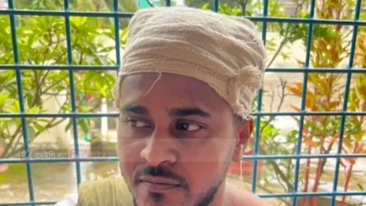 গাজীপুর কাপাসিয়া সন্ত্রাসের  হামলা শিকার যুবদল নেতা 