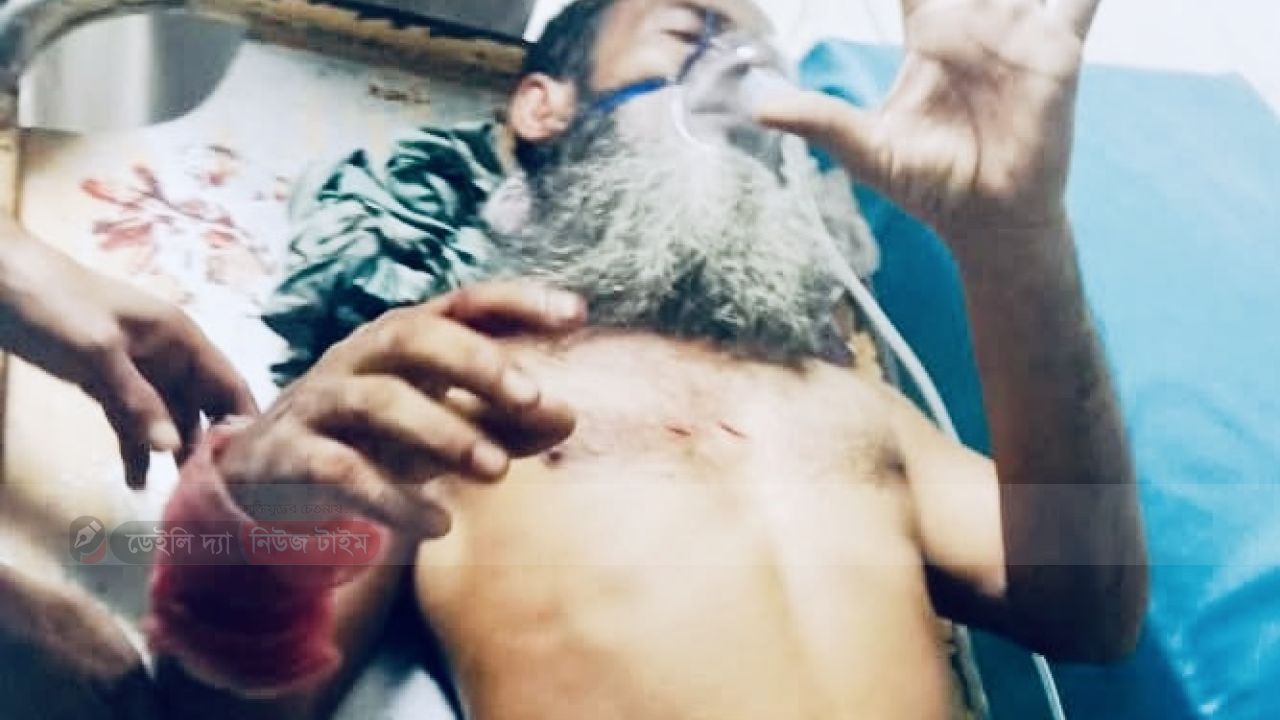 বগুড়া কাহালুতে চাকুর আঘাতে বৃদ্ধ গুরুতর আহত