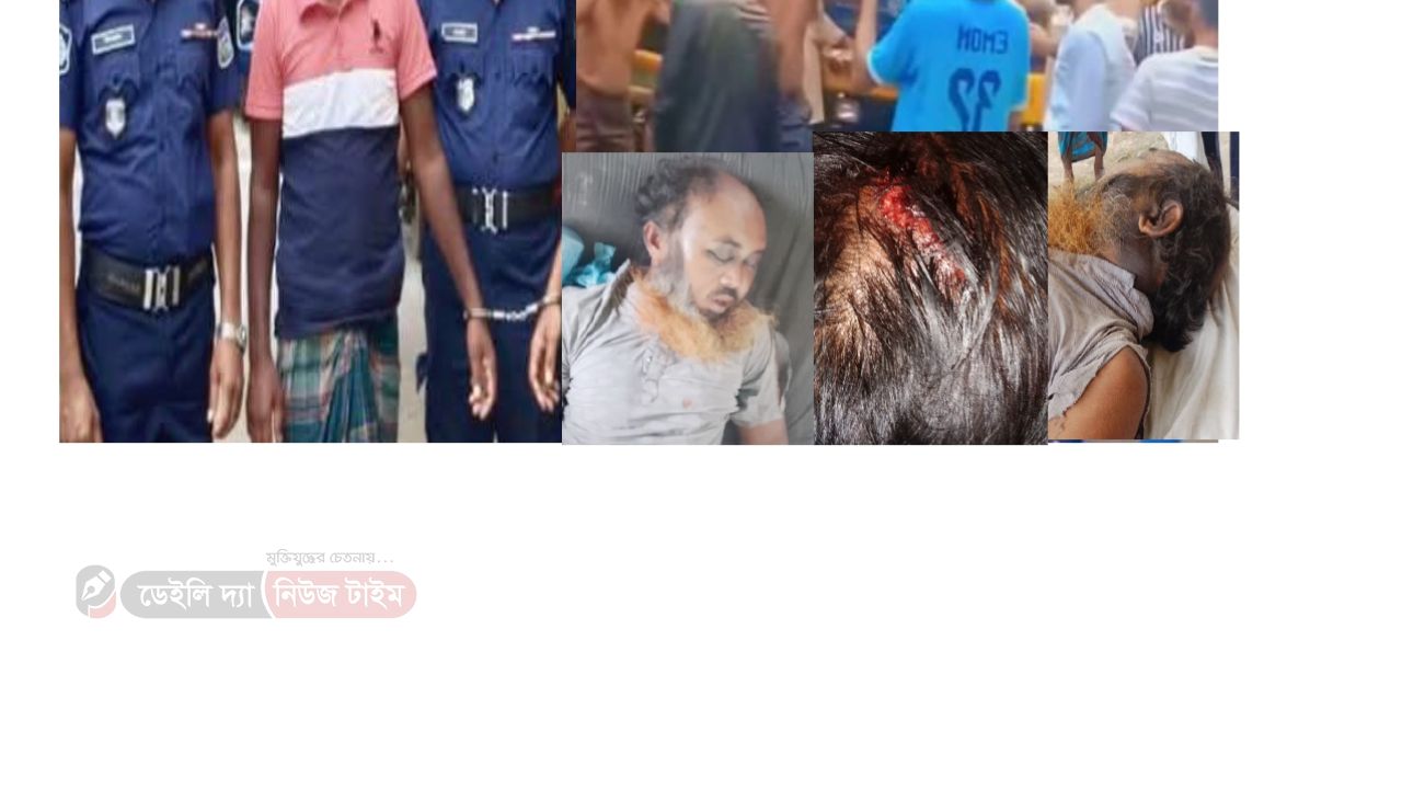 খেলাধুলা ও পূর্বের শত্রুতার  জেরে আসামিরা বাদিকে চখে চখে রেখে নিজ বাড়িতে গিয়ে আক্রমন করে মাথায় বাড়ি দিয়ে আহত করে পরে চিকিৎসাধীন অবস্থায় ইন্তেকাল করেন  । 