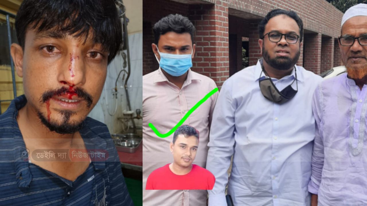 নীলফামারীর জলঢাকায় নিষিদ্ধ যুবলীগ সন্ত্রাসীর হাতে জখম নাজমুল ইসলাম