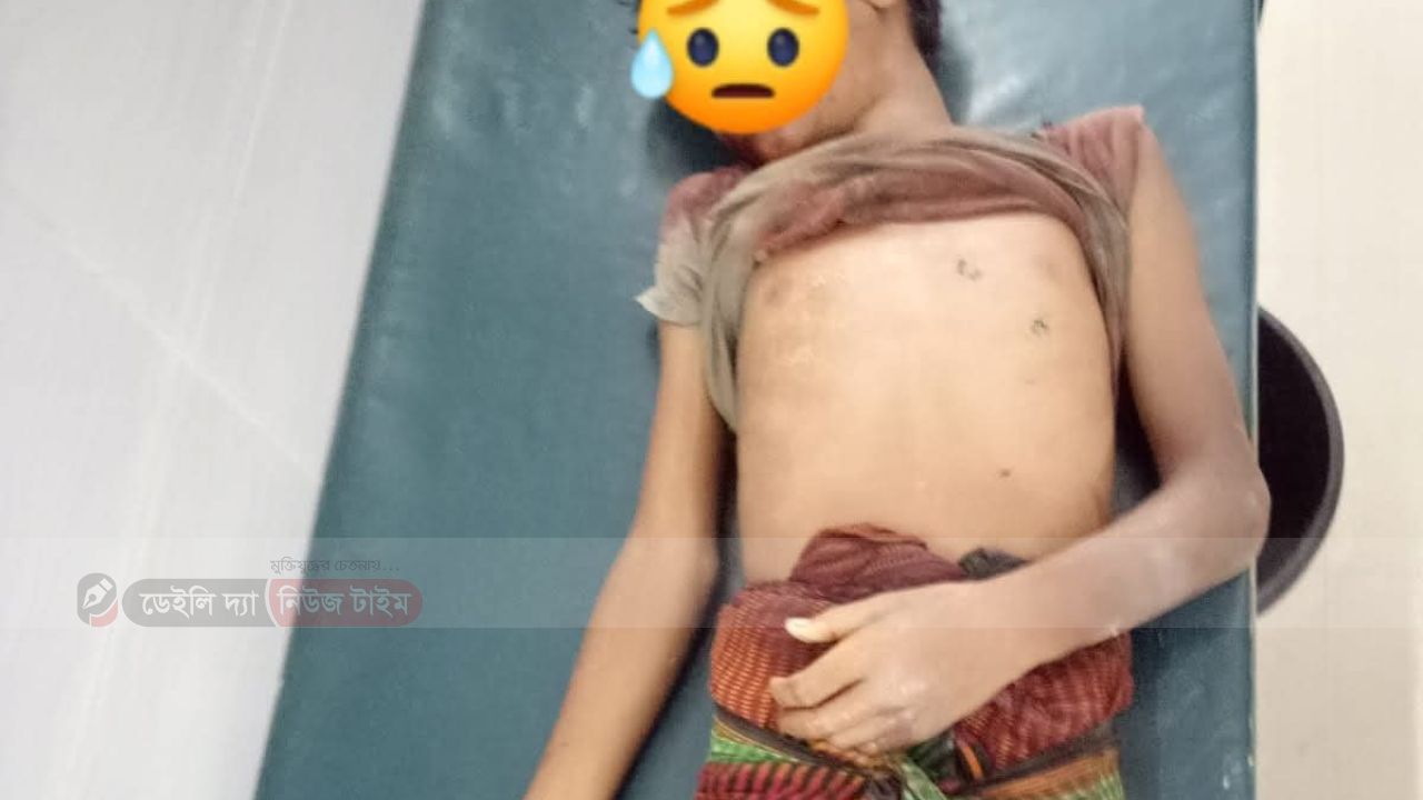 ইট ভাঙ্গাগাড়ির ধাক্কায় ১৪ বছরবয়সেরশিশুর মৃত্যু।