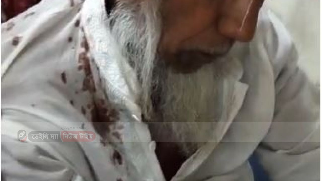 সালথায় বন্ধুকী টাকা ফেরত চাওয়ায় ৬৫ বছর বৃদ্ধকে মারধর, টেনে ছিঁড়ে ফেলে দাঁড়ি 