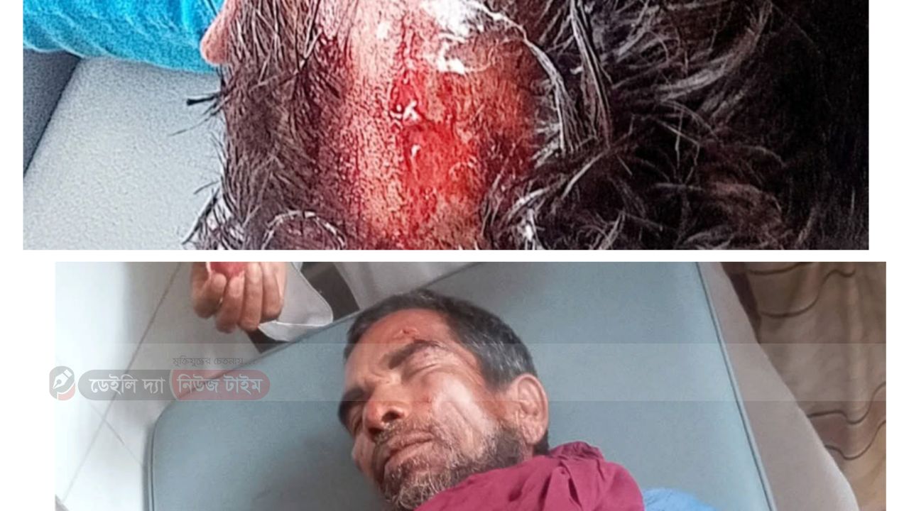 রায়পুর ইউনিয়নে জমি বিরোধের জেরে রক্তক্ষয়ী সংঘাত, পীরগঞ্জ হাসপাতালে চিকিৎসাধীন অনেকে