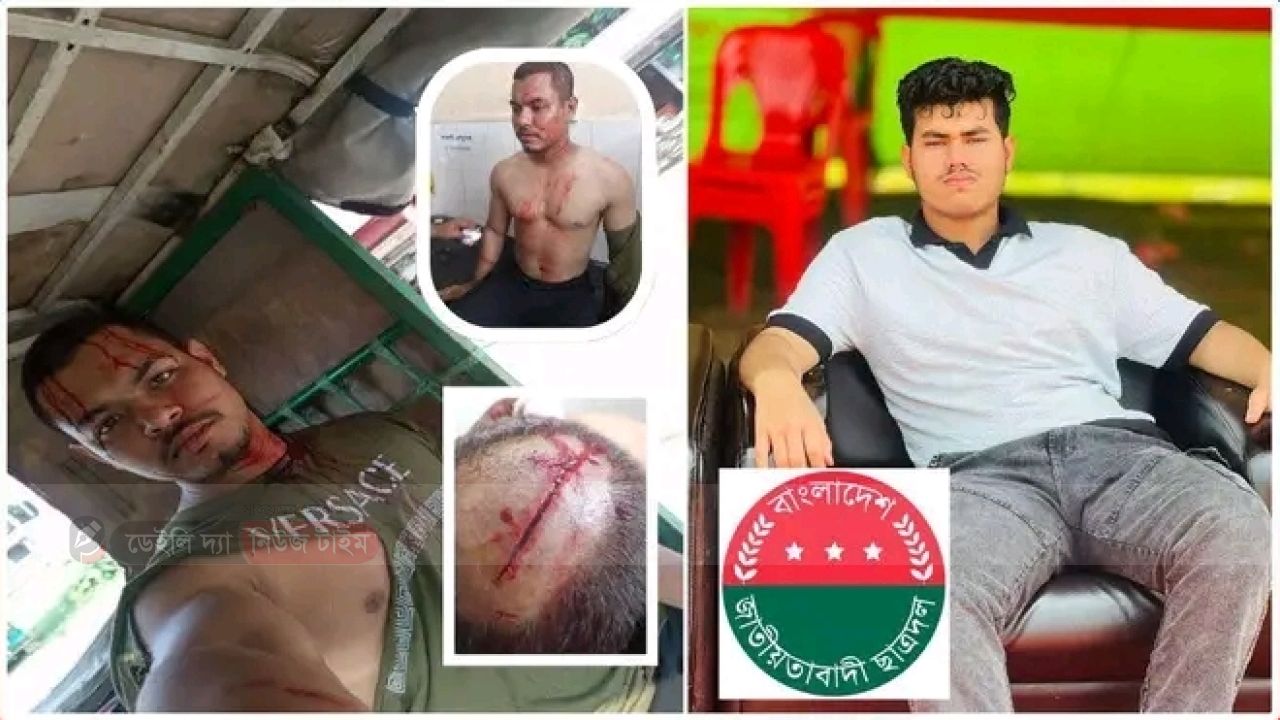ছাত্রদলের সন্ত্রাসী সালমানের হামলায় আহত মাদ্রাসার সাধারণ ছাত্র ফারদিন।