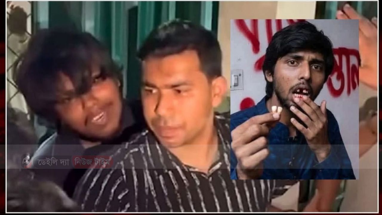 ফেসবুক পোস্টকে কেন্দ্র করে শাহবাগ থানায় সংঘর্ষ আহত দুই ডাকসু নেতা