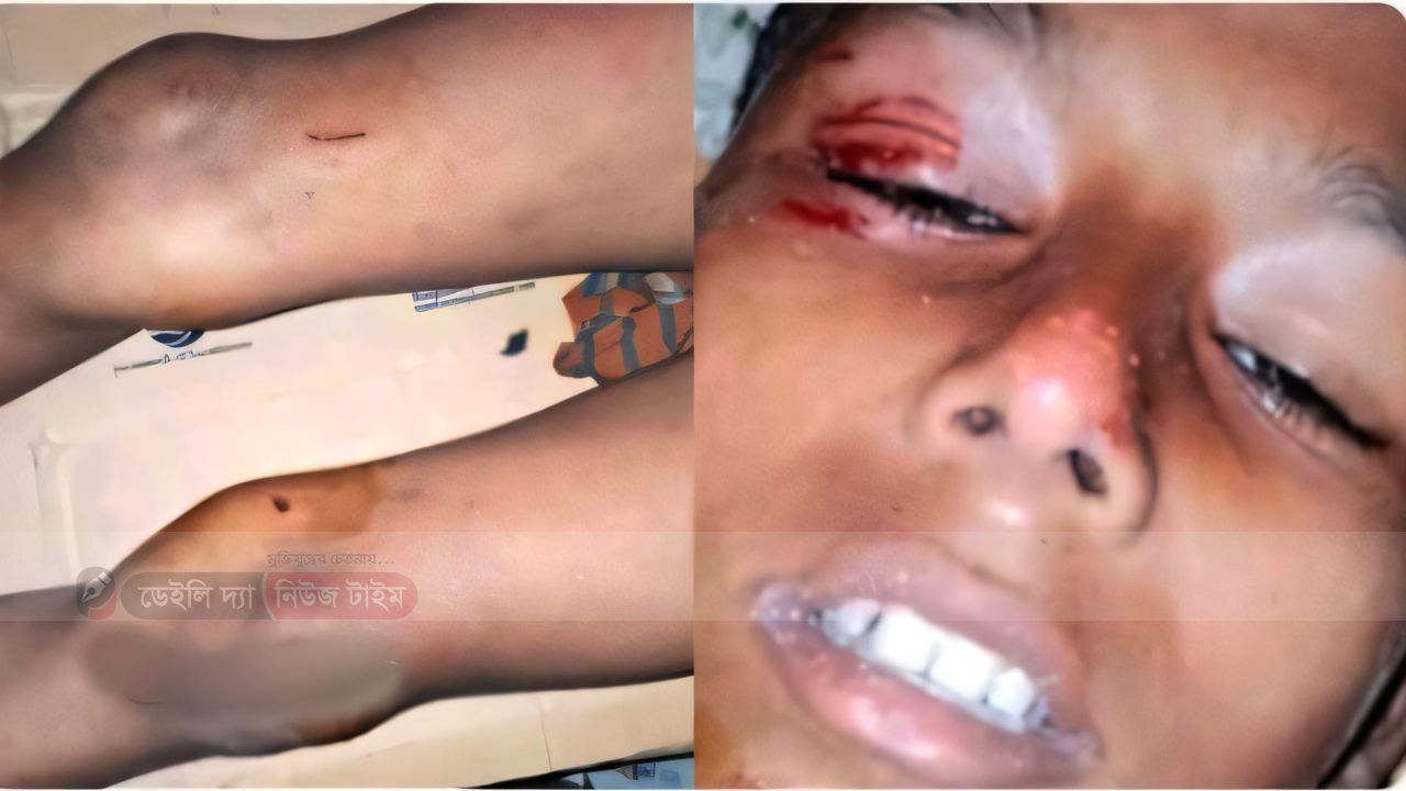 নীলফামারীতে মাদ্রাসার শিক্ষকের ব্যক্তিগত কাজে গিয়ে ছাত্র গুরুতর আহত... 